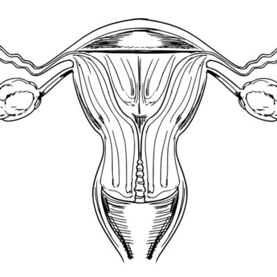 Mioma uterino